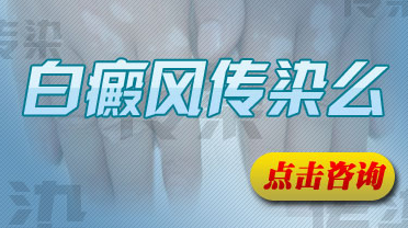 白癜风会遗传吗?